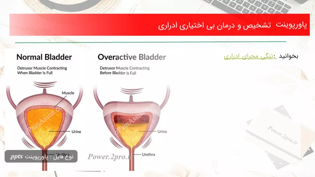 دانلود پاورپوینت تشخیص و درمان بی اختیاری ادراری - کد111395