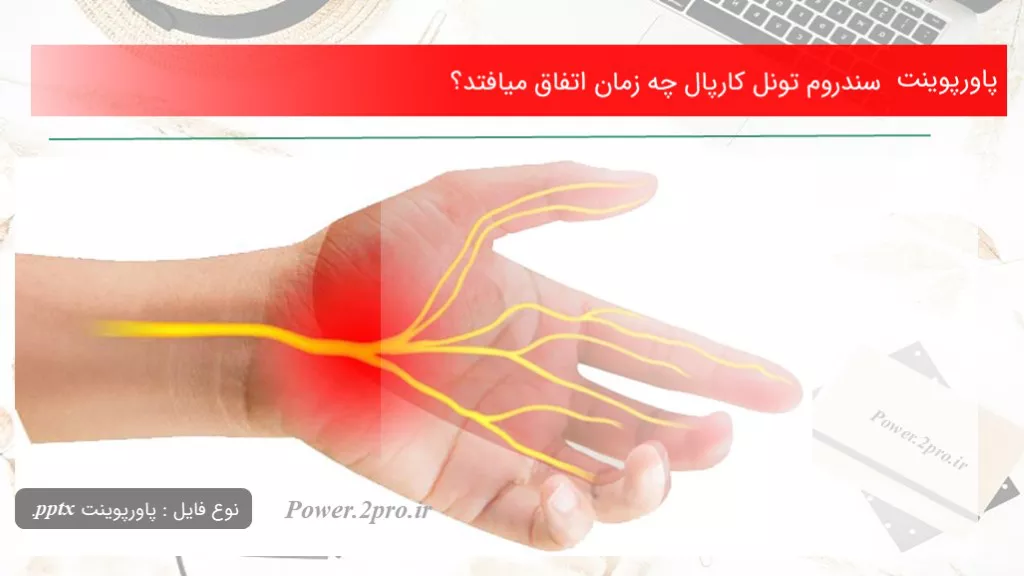 دانلود پاورپوینت سندروم تونل کارپال چه زمان اتفاق میافتد؟ - کد111402