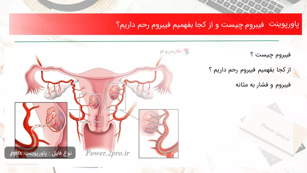 فیبروم چیست و از کجا بفهمیم فیبروم رحم داریم علائم فیبرومدرمان فیبر‌وم جلوگیری از مبتلا شدن به فیبروم؟