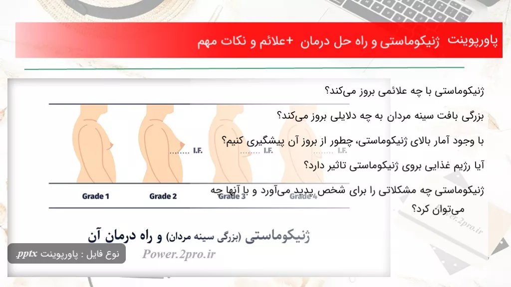 ژنیکوماستی و راه حل درمان + علائم و نکات مهم