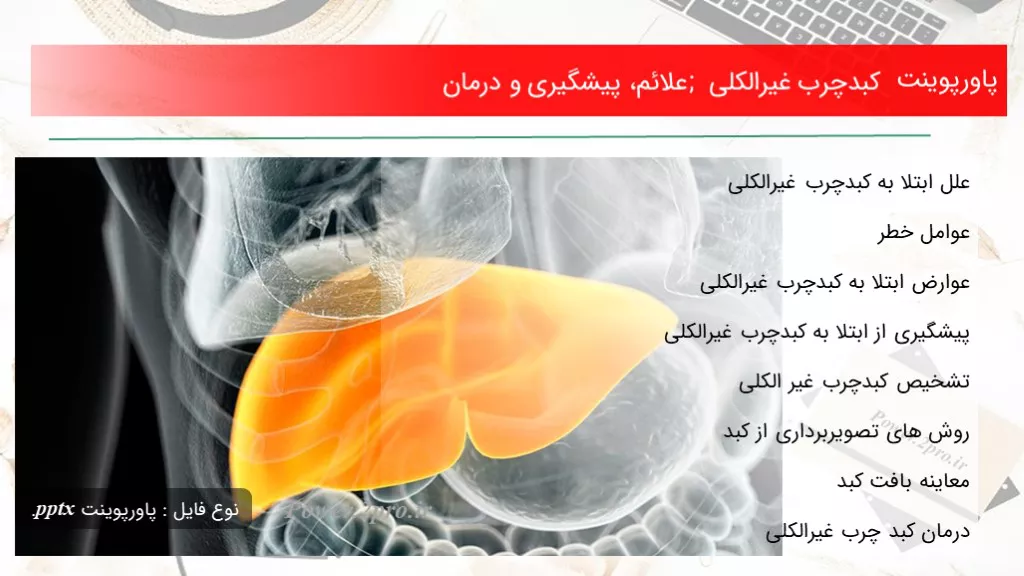 دانلود پاورپوینت کبدچرب غیرالکلی ; علائم، پیشگیری و درمان - کد111790