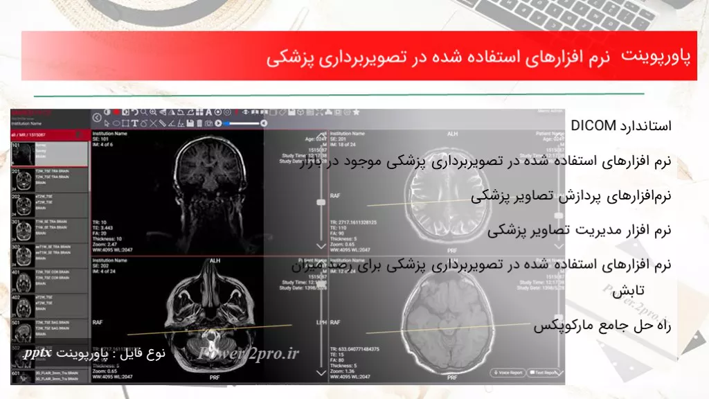 دانلود پاورپوینت تفاوت علائم بیماری های قلبی در زنان و مردان - کد112143