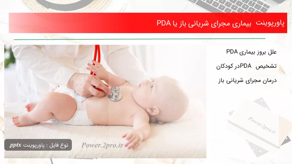 دانلود پاورپوینت بیماری مجرای شریانی باز یا PDA - کد112161