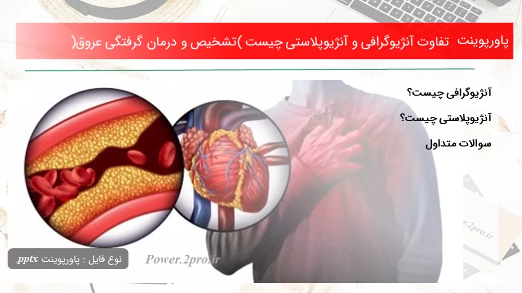 تفاوت آنژیوگرافی و آنژیوپلاستی چیست (تشخیص و درمان گرفتگی عروق)