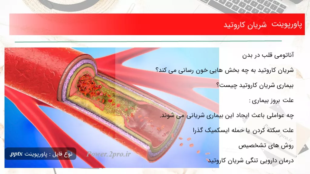 دانلود پاورپوینت شریان کاروتید - کد112188