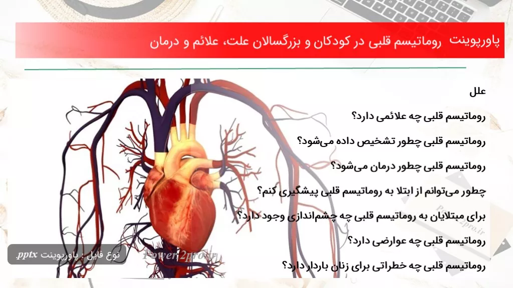 دانلود پاورپوینت روماتیسم قلبی در کودکان و بزرگسالان چرایی ، علائم و درمان - کد112191