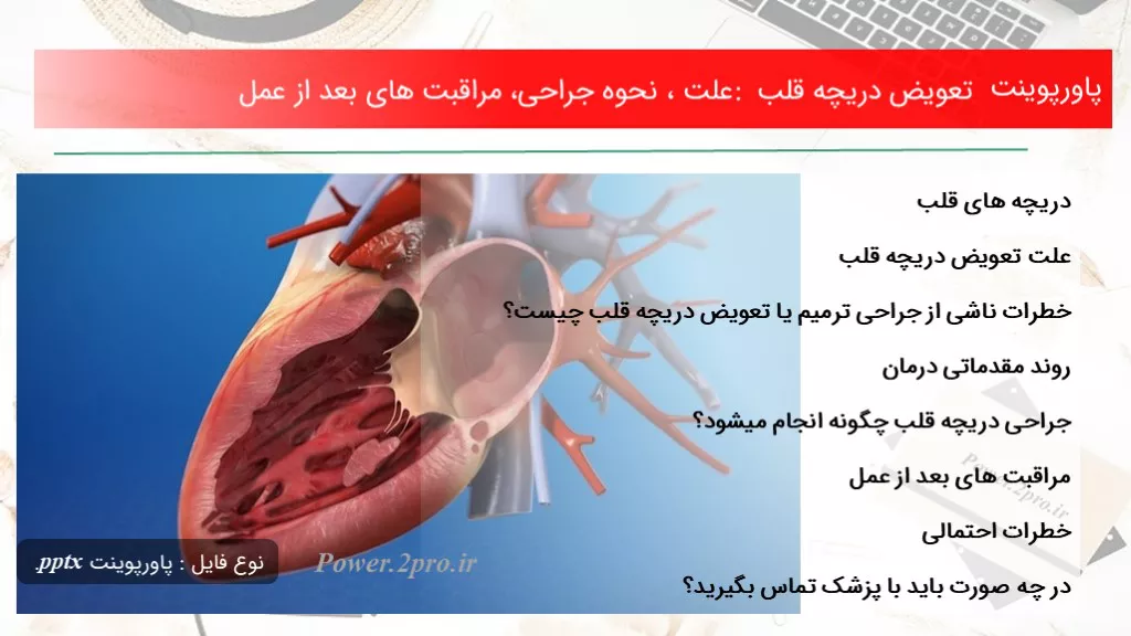 تعویض دریچه قلب : علت ، نحوه جراحی، مراقبت های بعد از عمل