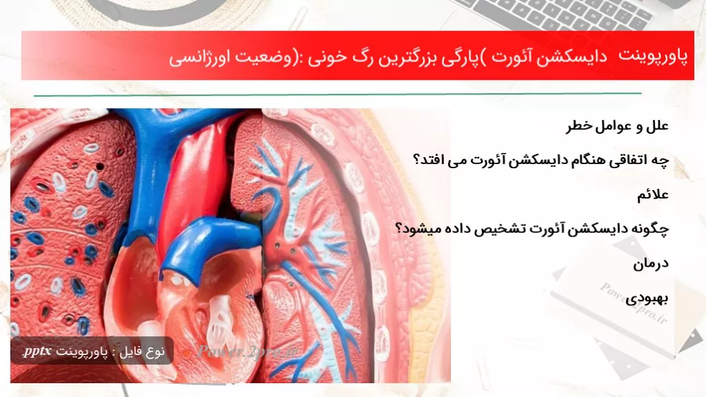 دانلود پاورپوینت دایسکشن آئورت (پارگی بزرگترین رگ خونی): حالت اورژانسی - کد112197