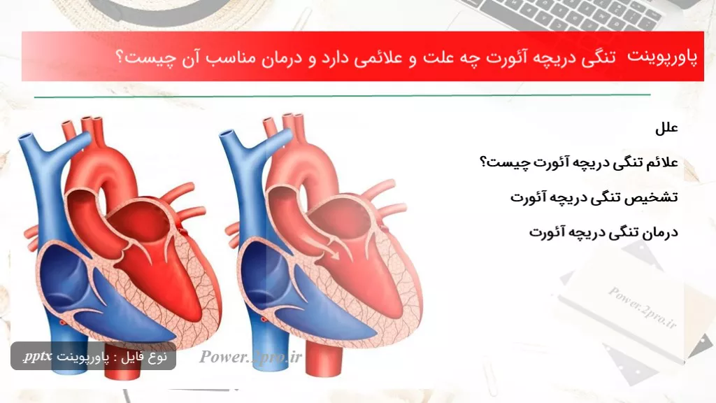 دانلود پاورپوینت تنگی دریچه آئورت چه چرایی و علائمی دارد و درمان مناسب آن چه چیزی است ؟ - کد112210