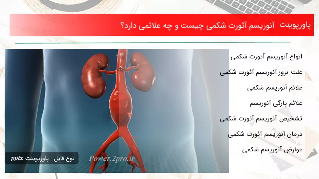 دانلود پاورپوینت آنوریسم آئورت شکمی چه چیزی است و چه علائمی دارد؟ - کد112219