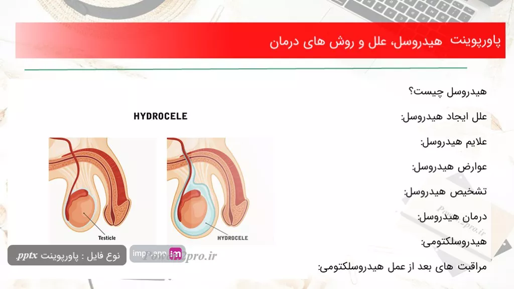 هیدروسل، علل و روش های درمان