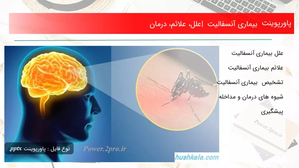 بیماری آنسفالیت | علل، علائم، درمان