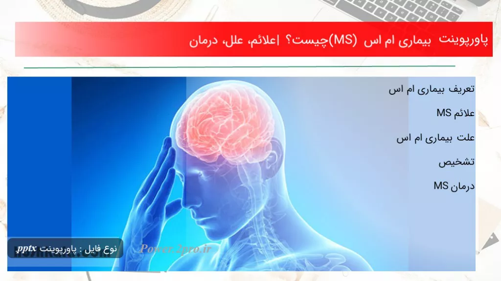 دانلود پاورپوینت بیماری ام اس (MS) چه چیزی است ؟ | علائم، علل، درمان - کد113318