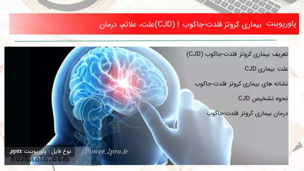 دانلود پاورپوینت بیماری کروتز فلدت-جاکوب (CJD) | چرایی ، علائم، درمان - کد113324