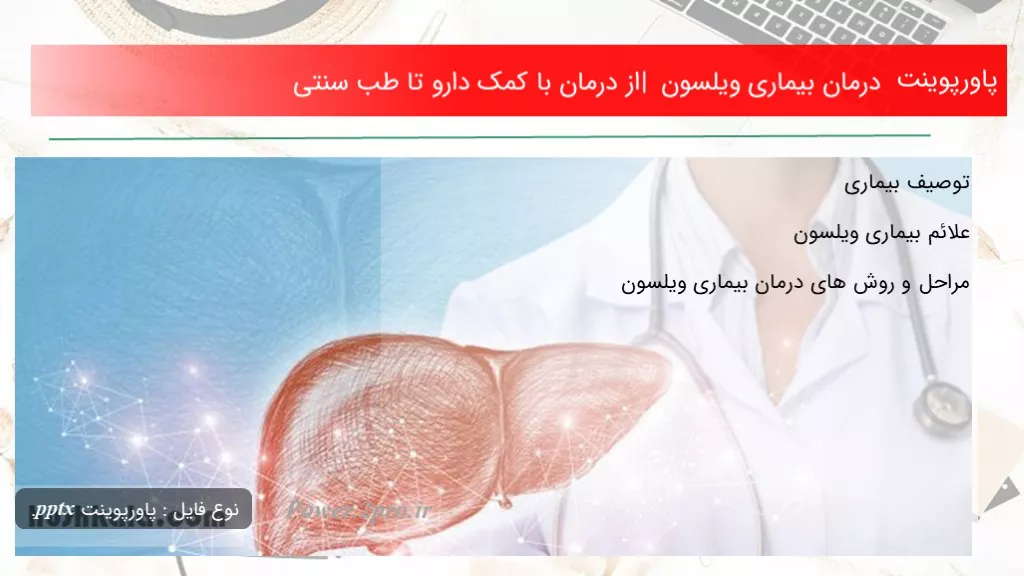 دانلود پاورپوینت درمان بیماری ویلسون | از درمان با کمک دارو تا طب سنتی - کد113376