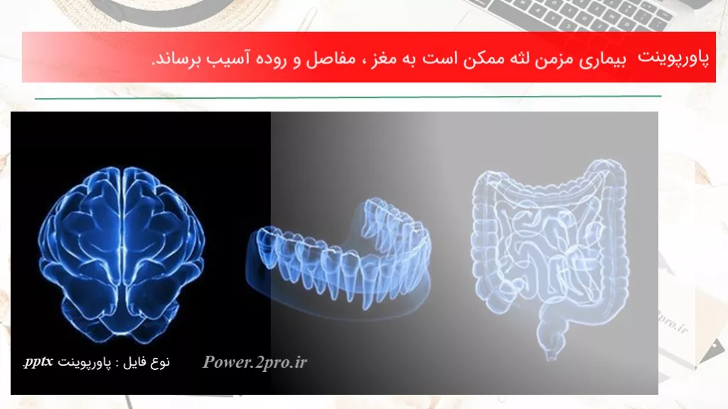 دانلود پاورپوینت بیماری مزمن لثه امکان‌پذیر است به مغز ، مفاصل و روده آسیب برساند. - کد113579