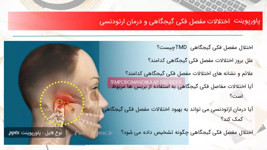 دانلود پاورپوینت اختلالات مفصل فکی گیجگاهی و درمان ارتودنسی - کد113805