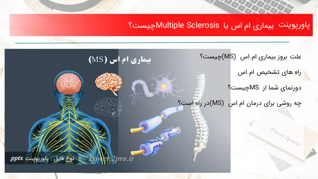 دانلود پاورپوینت بیماری ام اس یا Multiple Sclerosis چه چیزی است ؟ - کد114736