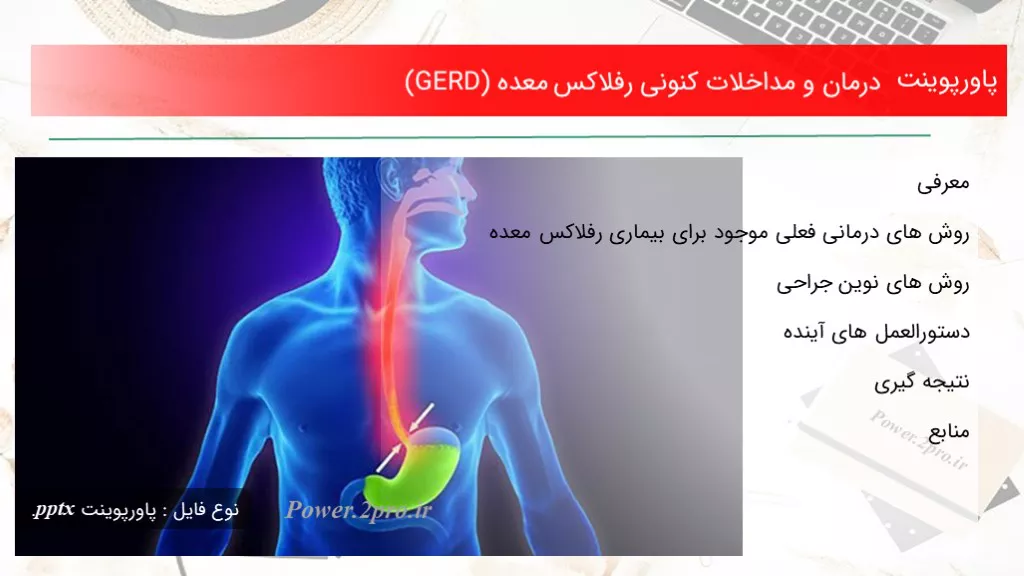 درمان و مداخلات کنونی رفلاکس معده (GERD)