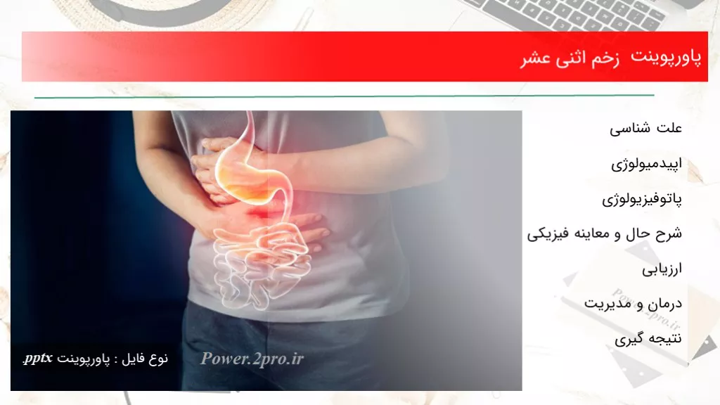 دانلود پاورپوینت زخم اثنی عشر - کد114802