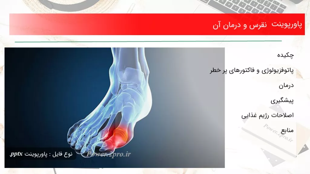 دانلود پاورپوینت نقرس و درمان آن - کد114918