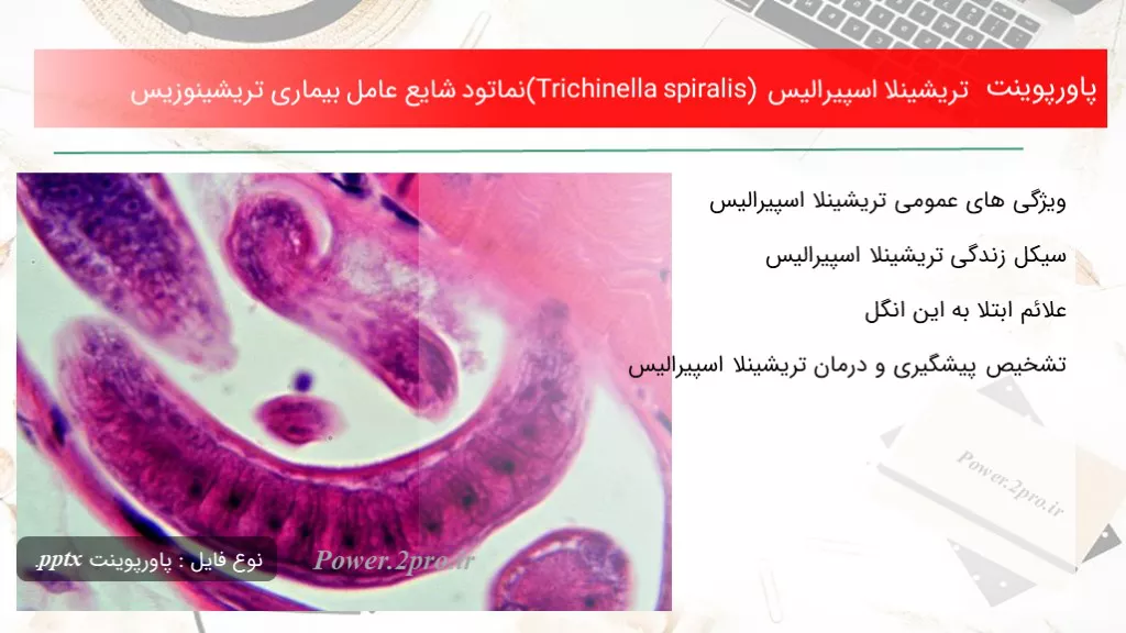 دانلود پاورپوینت تریشینلا اسپیرالیس (Trichinella spiralis) نماتود شایع عامل بیماری تریشینوزیس - کد115411