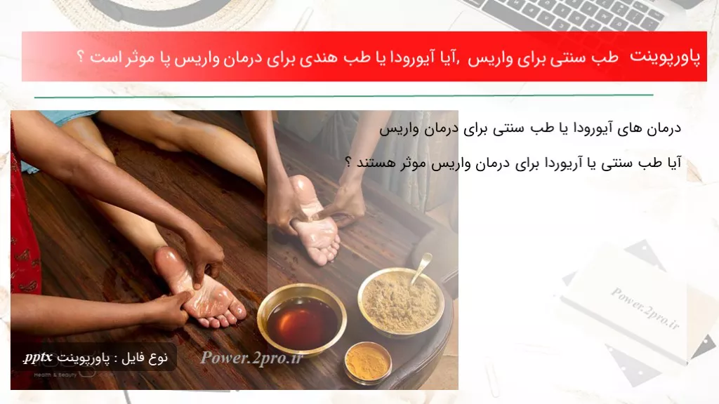 دانلود پاورپوینت طب سنتی  به منظور واریس , آیا آیورودا یا طب هندی  به منظور درمان واریس پا موثر است ؟ - کد115498