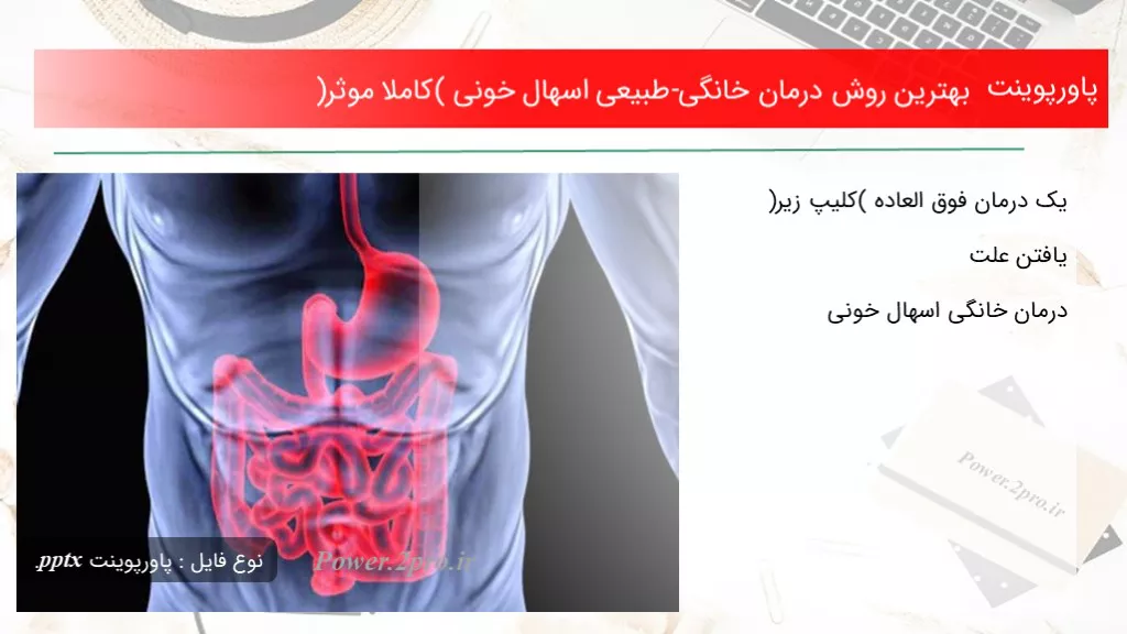 دانلود پاورپوینت بهترین چگونگی درمان خانگی-طبیعی اسهال خونی (کاملا موثر) - کد116112