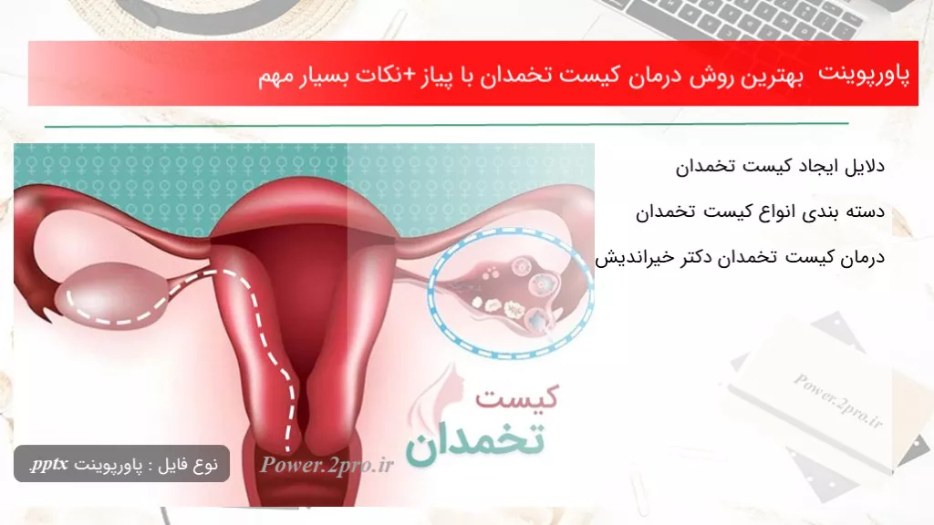 بهترین روش درمان کیست تخمدان با پیاز +نکات بسیار مهم