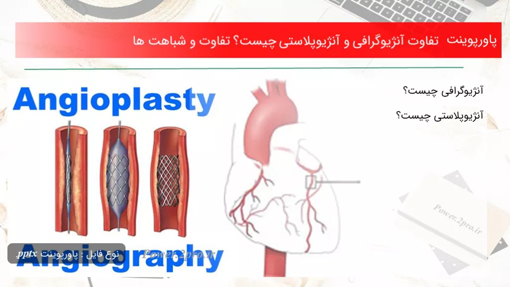 تفاوت آنژیوگرافی و آنژیوپلاستی چیست؟ تفاوت و شباهت ها