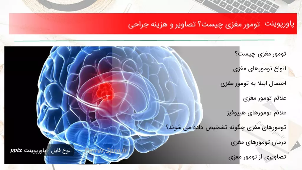 دانلود پاورپوینت تومور مغزی چه چیزی است ؟ تصاویر و هزینه جراحی - کد116170