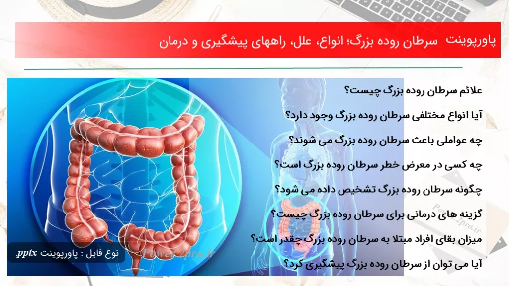 دانلود پاورپوینت سرطان روده بزرگ؛ انواع، علل، راههای پیشگیری و درمان - کد116246