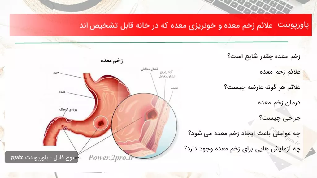 دانلود پاورپوینت علائم زخم معده و خونریزی معده که در خانه قابل تشخیص اند - کد116280