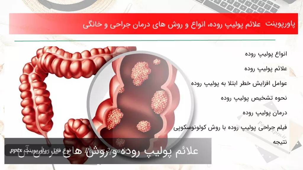 دانلود پاورپوینت علائم پولیپ روده، انواع و چگونگی های درمان جراحی و خانگی - کد116286