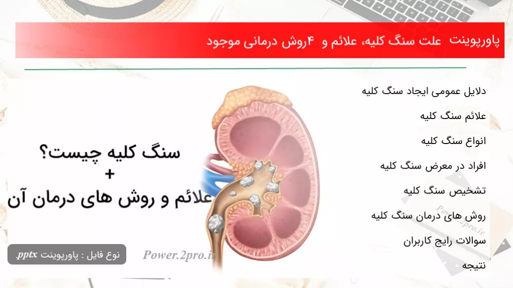 دانلود پاورپوینت چرایی سنگ کلیه، علائم و 4 چگونگی درمانی موجود - کد116294