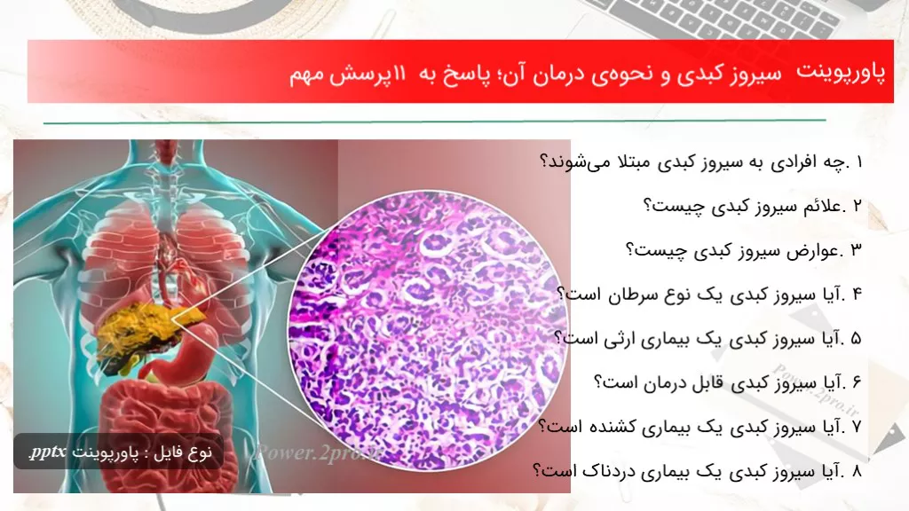 دانلود پاورپوینت سیروز کبدی و نحوه‌ی درمان آن؛ پاسخ به ۱۱ پرسش مهم - کد116611