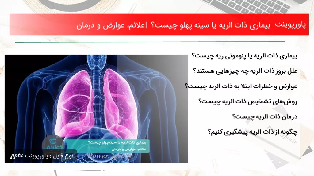 دانلود پاورپوینت بیماری ذات الریه یا سینه پهلو چه چیزی است ؟ | علائم، عوارض و درمان - کد116997