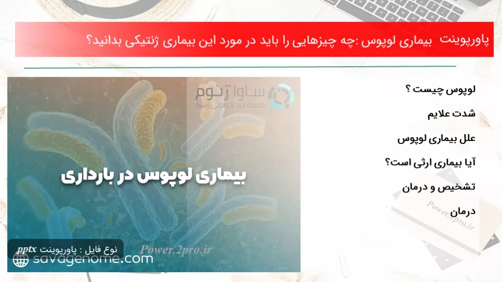 دانلود پاورپوینت بیماری لوپوس: چه چیزهایی را باید در ضمینه این بیماری ژنتیکی بدانید؟ - کد116998