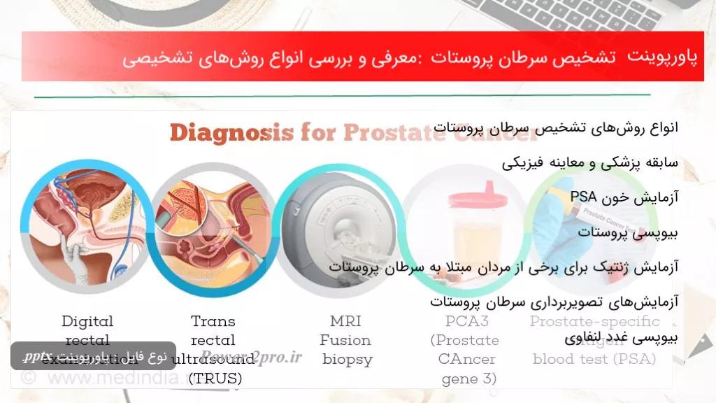 دانلود پاورپوینت تشخیص سرطان پروستات : معرفی و بررسی انواع روش‌های تشخیصی - کد117016