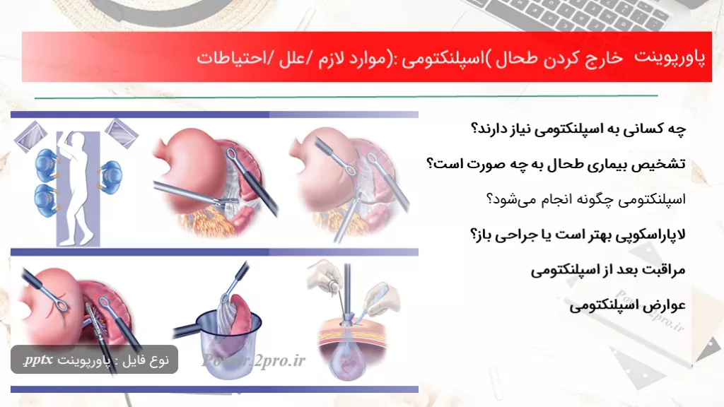 دانلود پاورپوینت خارج کردن طحال (اسپلنکتومی): موارد لازم/ علل/ احتیاطات - کد117055