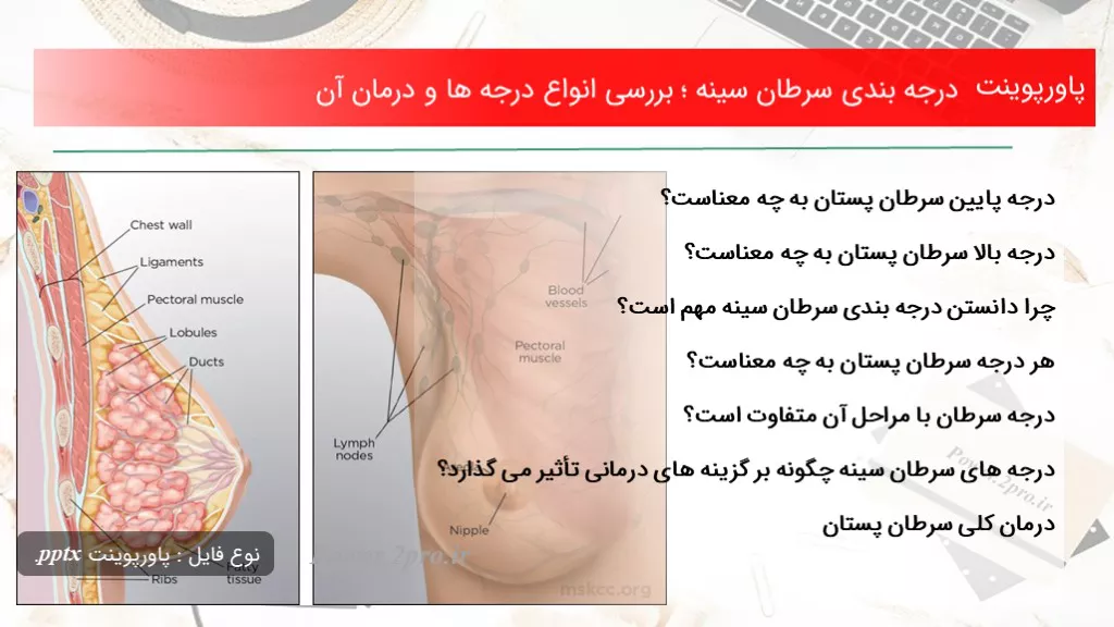 دانلود پاورپوینت درجه بندی سرطان سینه ؛ بررسی انواع درجه ها و درمان آن - کد117077