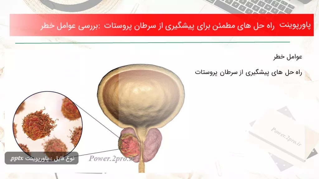 دانلود پاورپوینت راه حل های مطمئن  به منظور پیشگیری از سرطان پروستات : بررسی عوامل خطر - کد117105