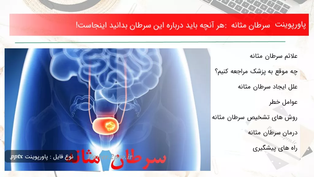 دانلود پاورپوینت سرطان مثانه : هر آنچه باید  درزمینه این سرطان بدانید اینجاست! - کد117150