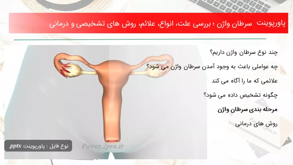 دانلود پاورپوینت سرطان واژن ؛ بررسی چرایی ، انواع، علائم، چگونگی های تشخیصی و درمانی - کد117151