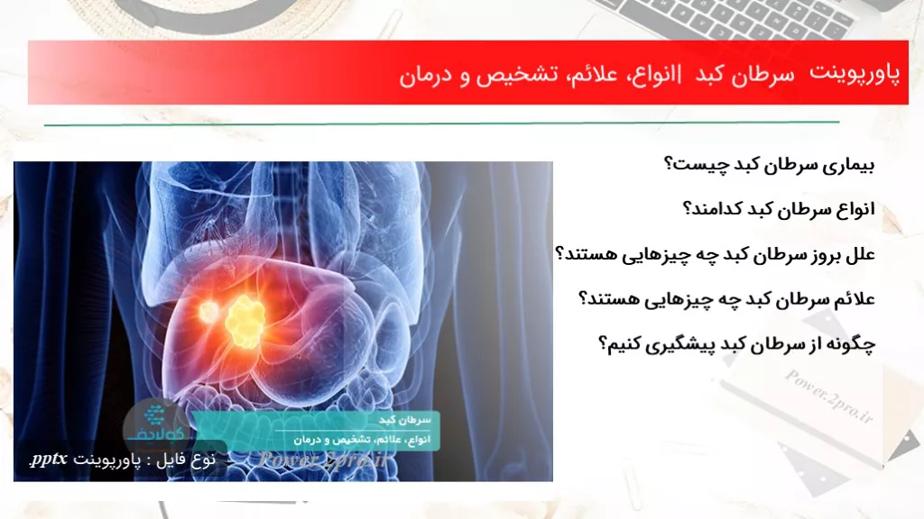 دانلود پاورپوینت سرطان کبد | انواع، علائم، تشخیص و درمان - کد117154