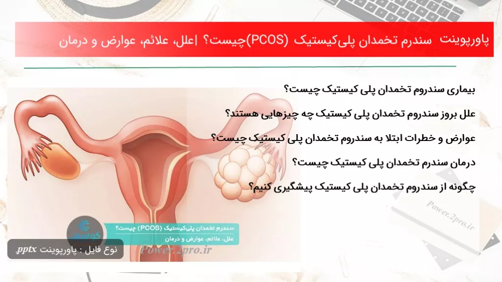 دانلود پاورپوینت سندرم تخمدان پلی‌کیستیک (PCOS) چه چیزی است ؟ | علل، علائم، عوارض و درمان - کد117161