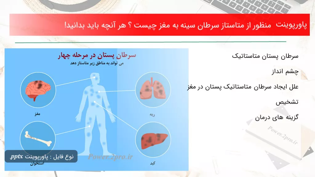 دانلود پاورپوینت منظور از متاستاز سرطان سینه به مغز چه چیزی است ؟ هر آنچه باید بدانید! - کد117290