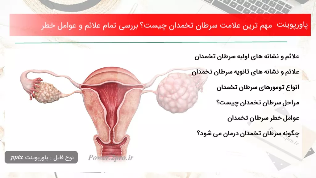 دانلود پاورپوینت مهم ترین علامت سرطان تخمدان چه چیزی است ؟ بررسی تمام علائم و عوامل خطر - کد117292