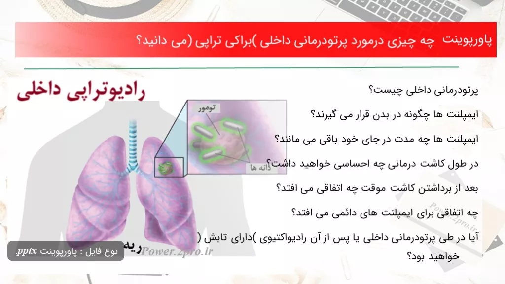 دانلود پاورپوینت چه چیزی درمورد پرتودرمانی داخلی (براکی تراپی) می دانید؟ - کد117390