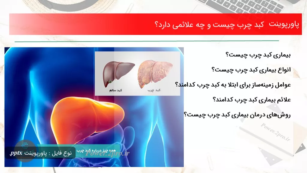 دانلود پاورپوینت کبد چرب چه چیزی است و چه علائمی دارد؟ - کد117422